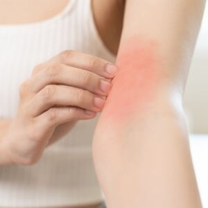 3 Signs That You May Have Sensitive Skin
